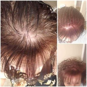 Selling treatment shampoo and conditioner and a mask for your hair help grow.